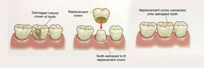 Periodontal Surgeon in kota
