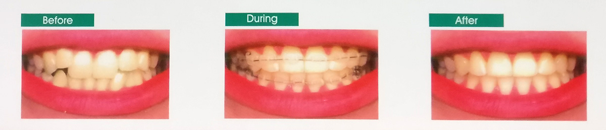 ortho 4