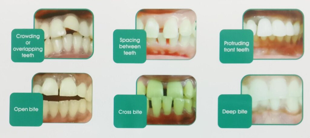 prob ortho scaled