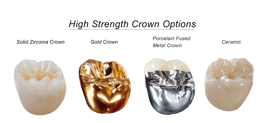 crownproscons2 1