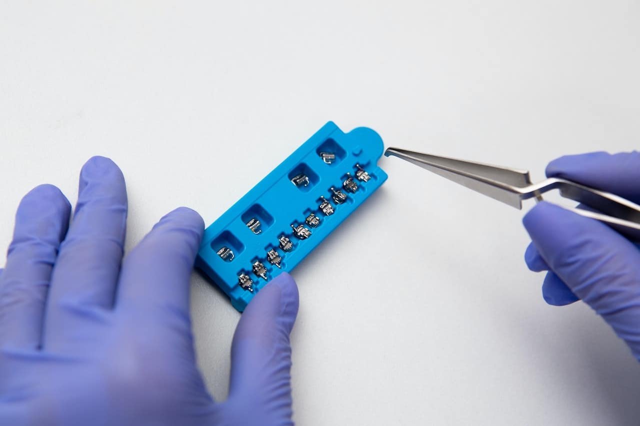 Differences Between Metal Braces Vs Ceramic Braces